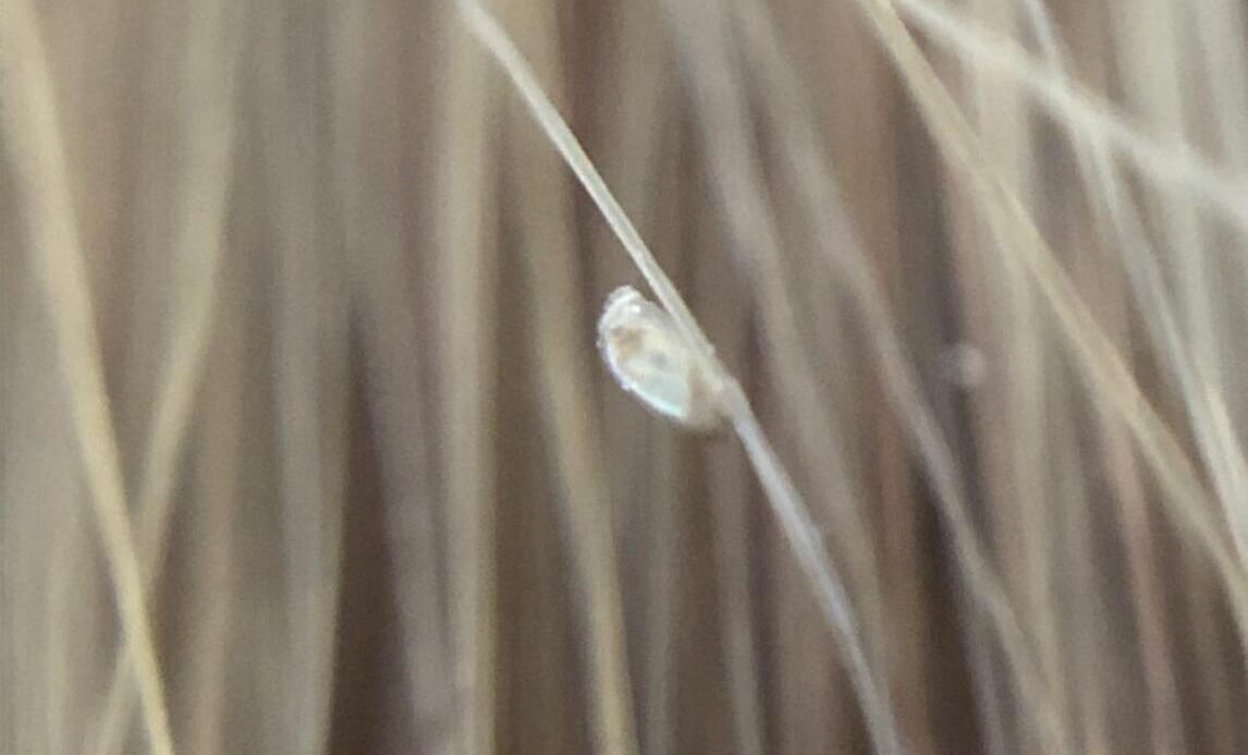 Lente morte